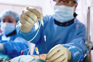 Radiofrequency Ablation