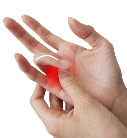 Trigger Finger