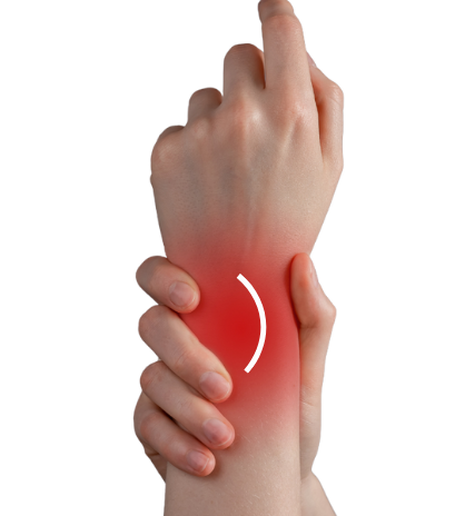 Wrist Tenosynovitis