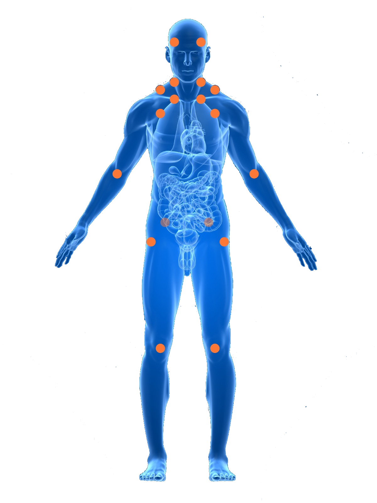 18 pain point Fibromyalgia