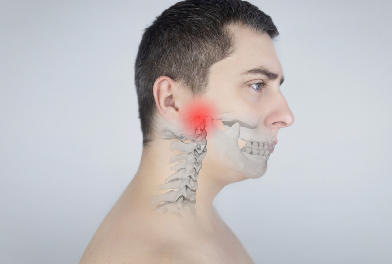Understanding TMJ Splints A Comprehensive Guide for Patients