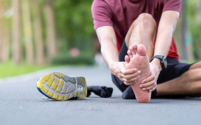 Effective Plantar Fasciitis Home Treatment: Steps to Alleviate Pain and Promote Healing