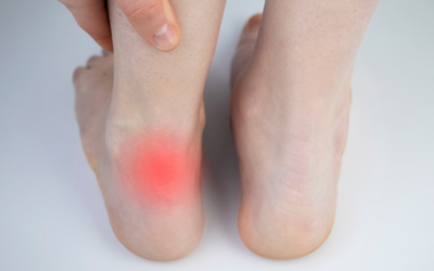 How to Cure Achilles Tendonitis Fast